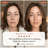 Antes y después — Jennifer, 44 años