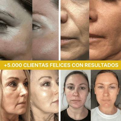 Queriva™ Deep Collagen