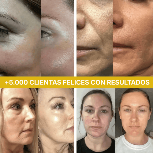 Queriva™ Deep Collagen 120 Da.