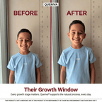 Before and after - their growth window