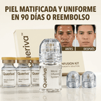 Queriva™ Sebo-Control