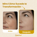 Queriva | TimeReverse®